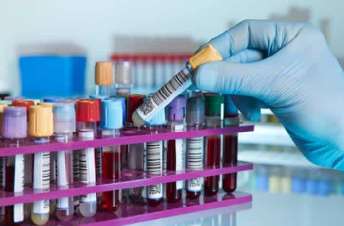 Gloved hand selecting a blood collection tube from a rack filled with labeled and color-coded vials in a clinical lab setting.