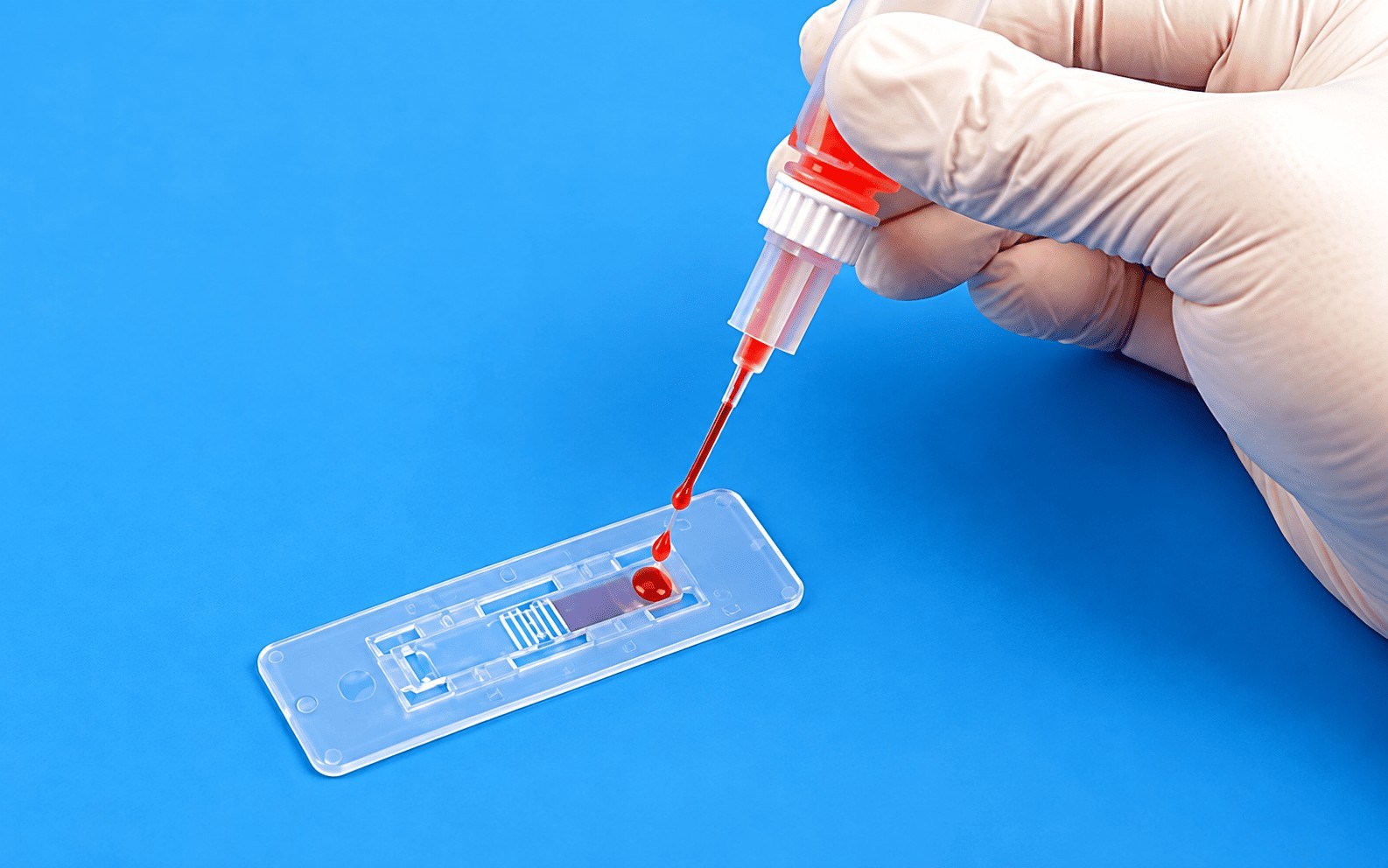 Medical Diagnostics | in vitro diagnostic medical devices